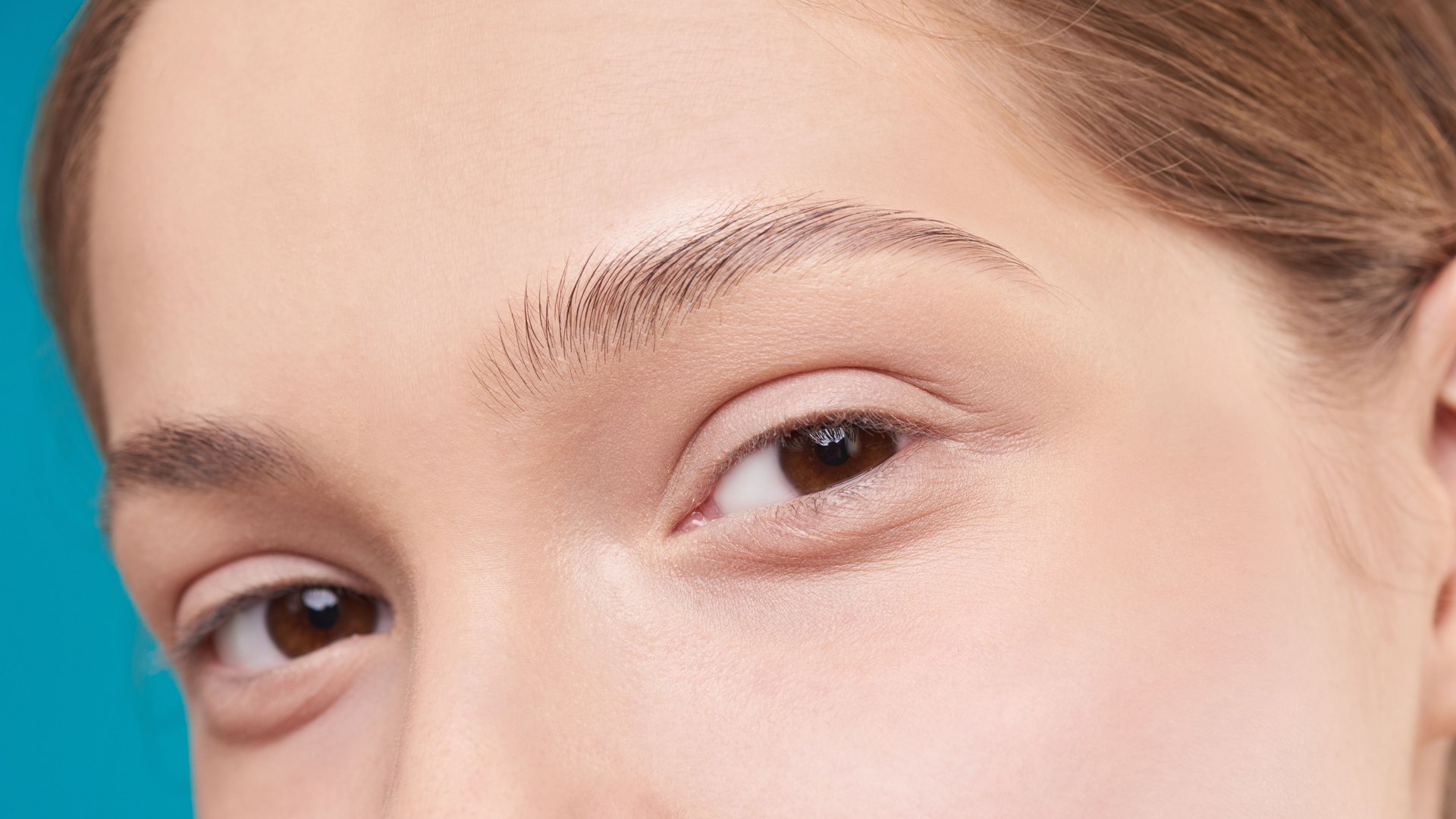 Blefaroplastias